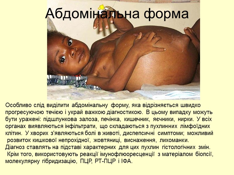 Абдомінальна форма Особливо слід виділити абдомінальну форму, яка відрізняється швидко  прогресуючою течією і